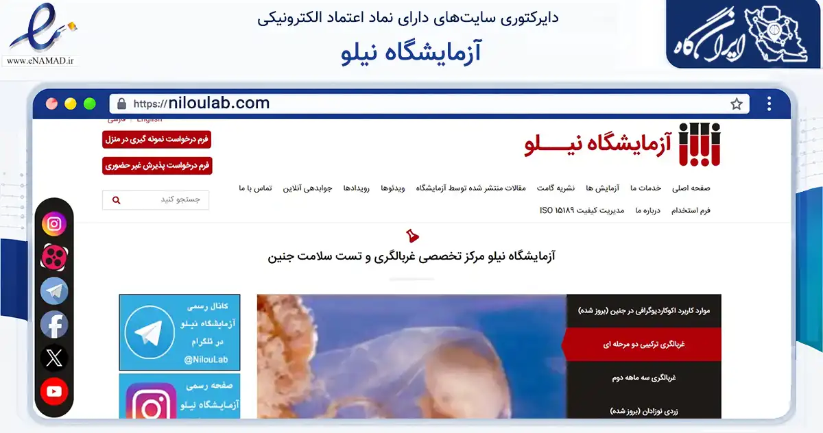 صفحه اصلی سایت آزمایشگاه نیلو به نشانی niloulab.com که در زمینه سلامت، درمان و پزشکی با مرکزیت تهران فعالیت دارد.